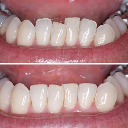 Αισθητική Οδοντιατρική Denta